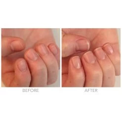 KurNail Cream Restorative -Beauty Verkoop aCeahs846721 2 dgl BE