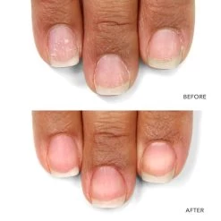 KurNail Probiotic Instant Boost 7 KurNail Probiotic Instant Boost -Beauty Verkoop nYX7xv1064033 2 dgl BE