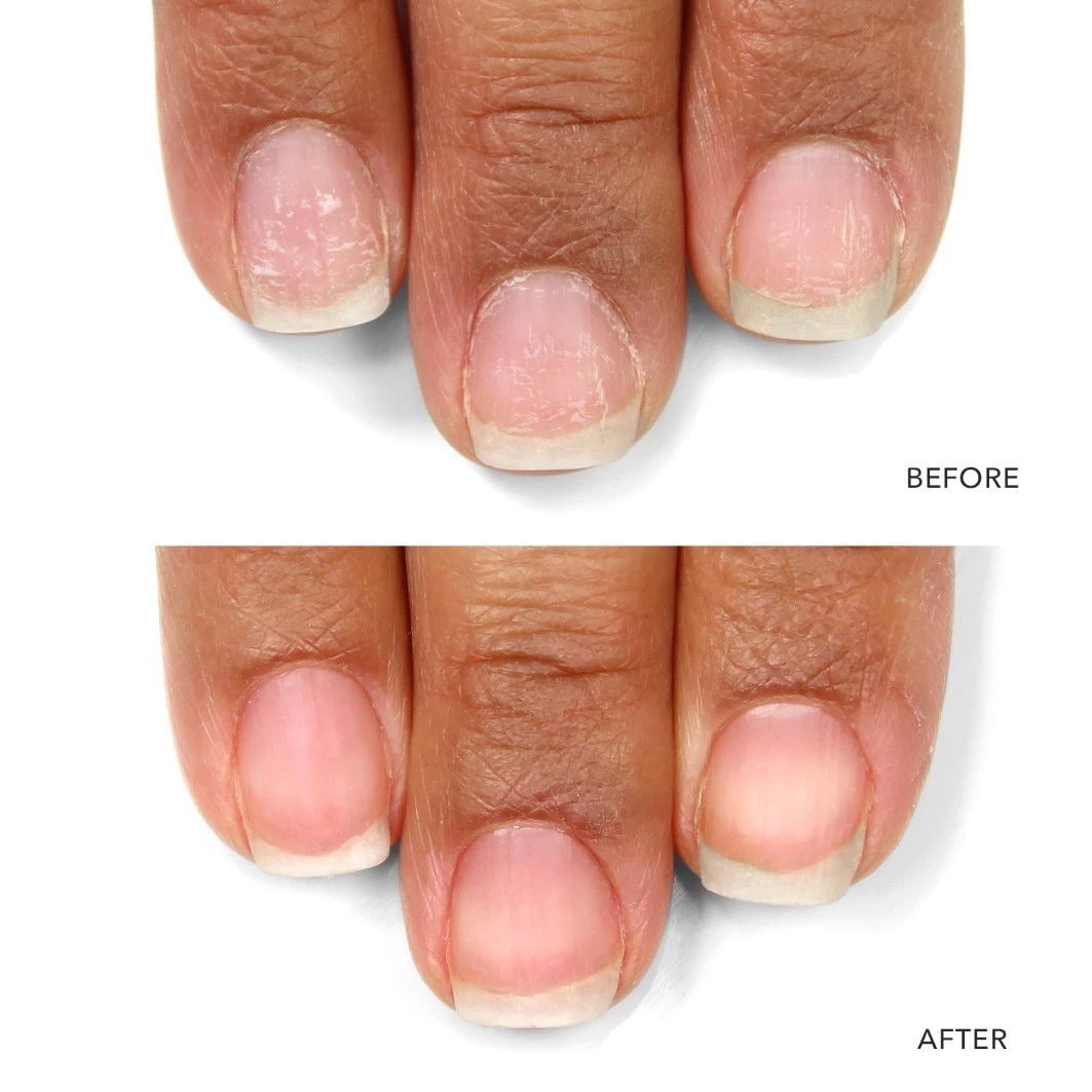 KurNail Probiotic Instant Boost 3 KurNail Probiotic Instant Boost - Afbeelding 3